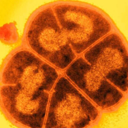 Deinococcus radiodurans☑️ SFS UNIVERSE
